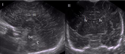 The ABCs of transfontanellar ultrasound and more